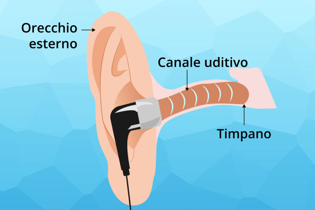 placement_diagram